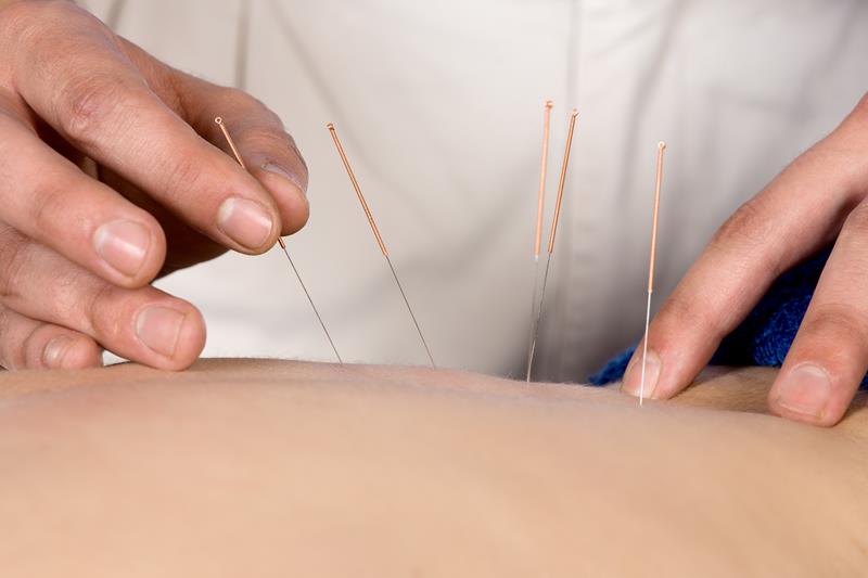 Acupuncture  Highlands Ranch, CO 