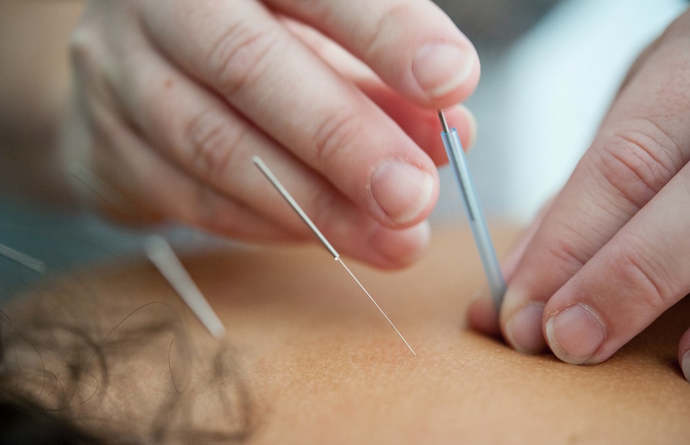 Dry Needling  Highlands Ranch, CO 